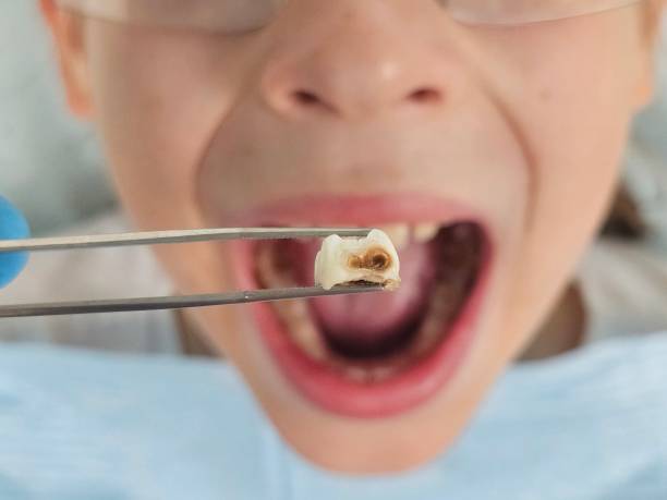 Best Emergency Dentist for Knocked-Out Tooth in Ecorse, MI